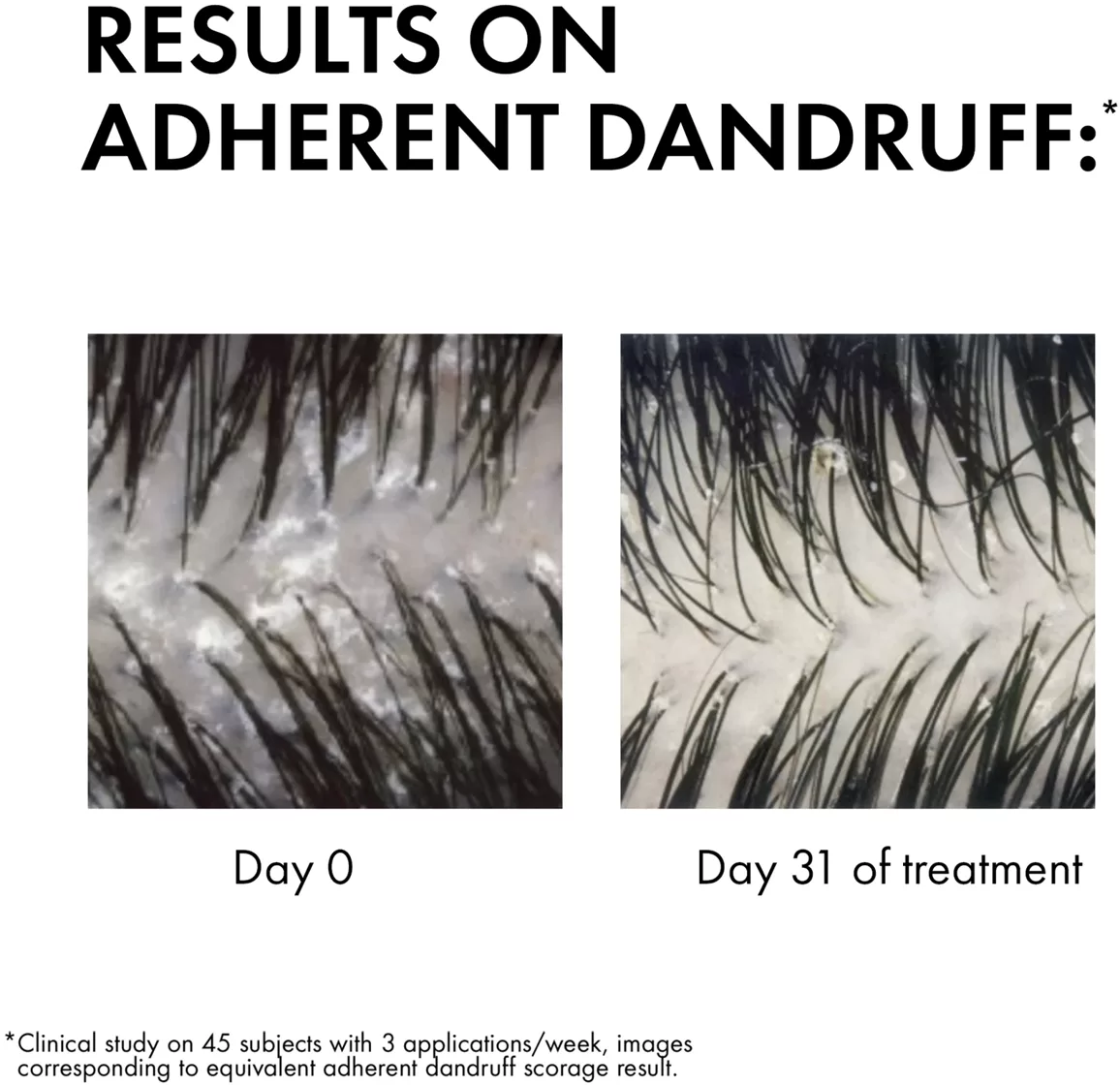 dercos-anti-dandruff___240927__1_.webp